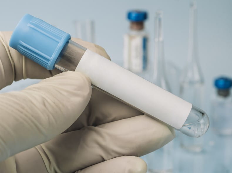 Test tubes